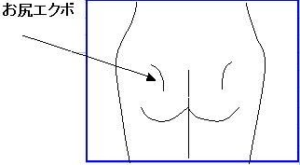 お尻がたれるサイン お尻エクボとは ラクレ 沖縄 糸満市潮平で脱毛 痩身 フェイシャルなら